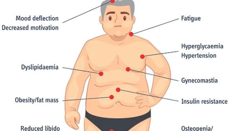 hypogonadism and trt