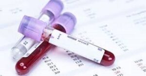 Blood test for testosterone jakarta