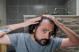 Man checking hair loss in mirror before starting finasteride and minoxidil treatment